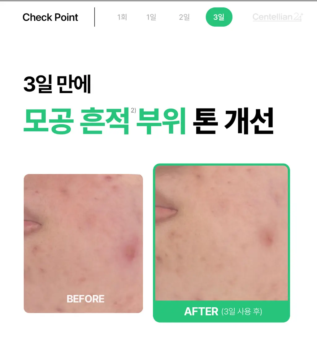 [1등 모공세럼] 센텔리안24 마데카 분말 티트리 에이씨 기획 (겔 세럼 15ml) 상세페이지 18